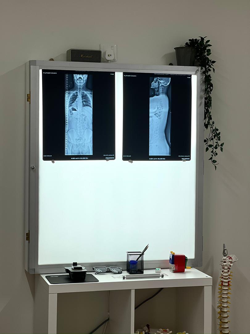 Clinical X-ray viewing area used during patient assessments